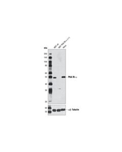 Cell Signaling PKA RI-alpha (D54D9) Rabbit mAb 20 uL