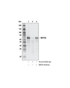 Cell Signaling Mef2d Antibody