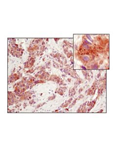 Cell Signaling Perk (D11a8) Rabbit mAb