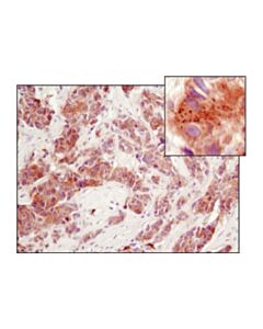 Cell Signaling Perk (D11a8) Rabbit mAb