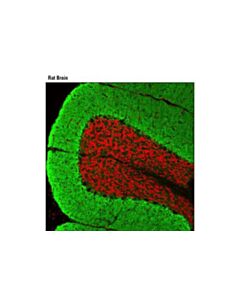 Cell Signaling Eaat1 (D44e2) Xp Rabbit mAb