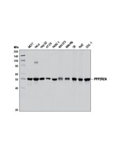 Cell Signaling Ppp2r2a (2g9) Mouse mAb