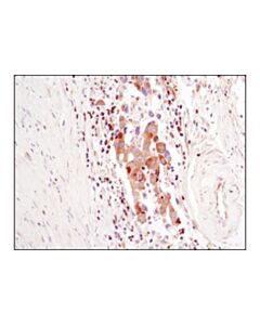 Cell Signaling Plcgamma1 (D9h10) Xp Rabbit mAb