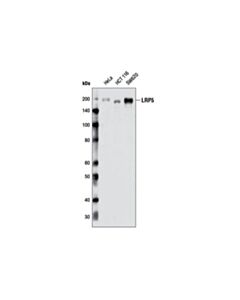 Cell Signaling Lrp5 (D80f2) Rabbit mAb