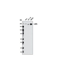 Cell Signaling LRP5 (D80F2) Rabbit mAb 20 uL