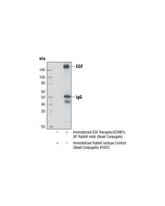 Cell Signaling Egf Receptor (D38b1) Xp Rabbit mAb (Sepharose Bead Conjugate)