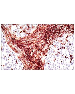 Cell Signaling Vimentin (D21h3) Xp Rabbit mAb