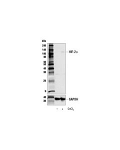 Cell Signaling HIF-2alpha (E2N9W) Rabbit mAb 20 uL