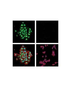 Cell Signaling Mgmt (E6m7v) Rabbit mAb
