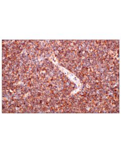 Cell Signaling Cd62l/L-Selectin (E7x9i) Rabbit mAb