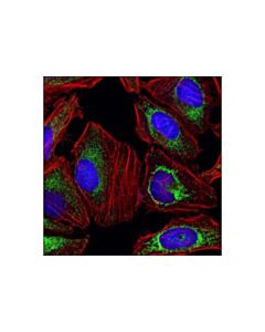 Cell Signaling Sdha Antibody