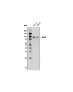 Cell Signaling Axin2 (D48g4) Rabbit mAb