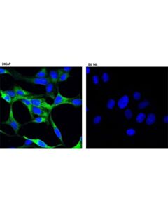 Cell Signaling Psa/Klk3 (D2a8) Rabbit mAb