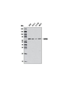 Cell Signaling Grk6 (D1a4) Rabbit mAb