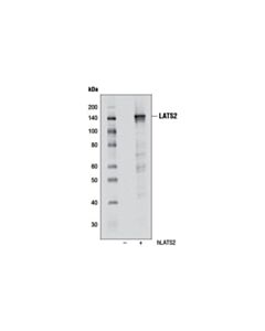 Cell Signaling Lats2 (D83d6) Rabbit mAb
