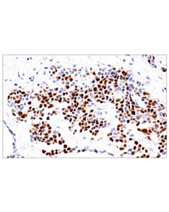 Cell Signaling Myogenin (Lo26) Mouse mAb