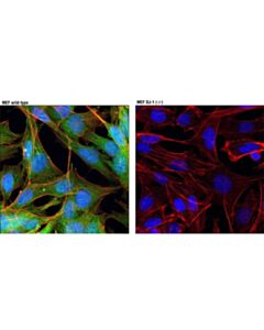 Cell Signaling Dj-1 (D29e5) Xp Rabbit mAb