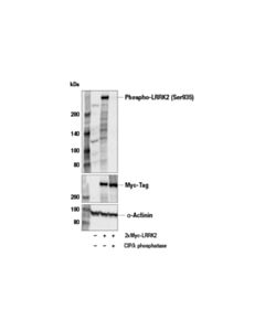Cell Signaling Phospho-Lrrk2 (Ser935) Antibody