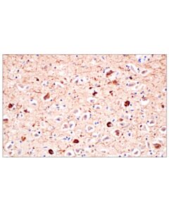Cell Signaling Phospho-Tau (Ser202) (F2A2F) Rabbit mAb 100 uL