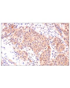 Cell Signaling CRBN (F4I7F) Rabbit mAb