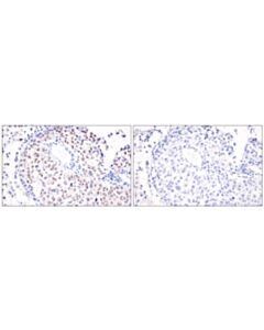 Cell Signaling Mitf (D5) Mouse mAb