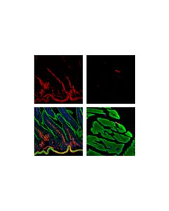 Cell Signaling Alpha-Smooth Muscle Actin (D4k9n) Xp Rabbit mAb (Alexa Fluor 555 Conjugate)