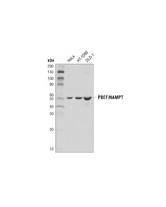 Cell Signaling PBEF/NAMPT (D1K6D) Rabbit mAb 20 uL