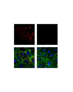 Cell Signaling Cd31 (Pecam-1) (89c2) Mouse mAb (Alexa Fluor 555 Conjugate)