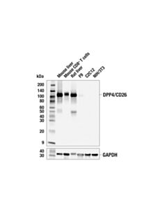 Cell Signaling Dpp4/Cd26 (E2v5i) Rabbit mAb