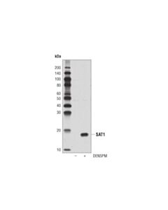 Cell Signaling Sat1 (D1t7m) Rabbit mAb
