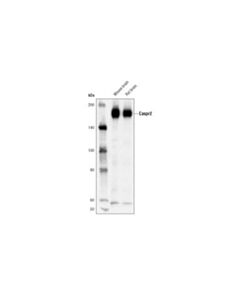 Cell Signaling Caspr2 (D6s1o) Rabbit mAb