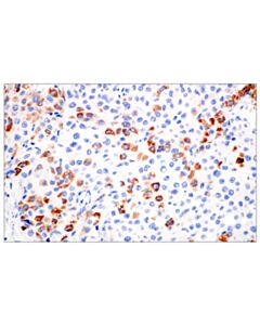 Cell Signaling Cps1 (E9i9u) Rabbit mAb