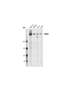 Cell Signaling SMRT (D8D2L) Rabbit mAb 20 uL