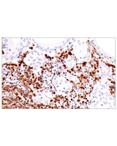 Cell Signaling Tnfrsf13c/Baff-R (E3c1q) Xp ® Rabbit mAb