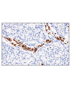 Cell Signaling Irf-4 (E8h3s) Xp Rabbit mAb