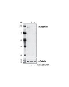 Cell Signaling Signalsilence Her2/Erbb2 Sirna Ii