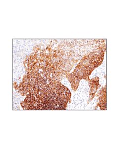 Cell Signaling Cd47 (D3o7p) Rabbit mAb