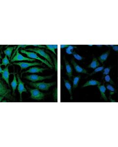 Cell Signaling Signalsilence Gsk-3alpha/Beta Sirna