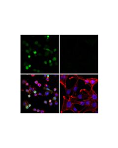 Cell Signaling p47phox (F3Y6C) Rabbit mAb 100 uL