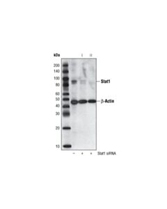 Cell Signaling Signalsilence Stat1 Sirna I