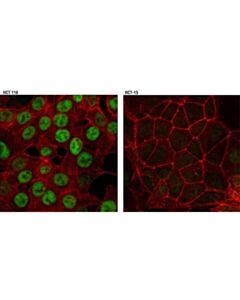 Cell Signaling Chk2 (D9c6) Xp Rabbit mAb
