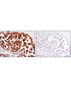Cell Signaling Phospho-Epha2 (Ser897) (D9a1) Rabbit mAb