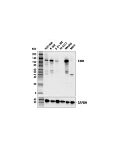 Cell Signaling Exo1 (E6p2b) Rabbit mAb