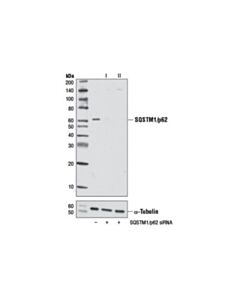 Cell Signaling Signalsilence Sqstm1/P62 Sirna I