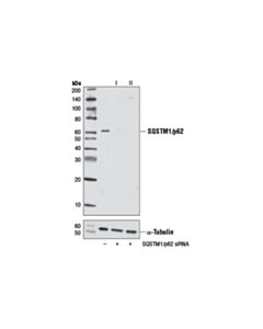 Cell Signaling Signalsilence Sqstm1/P62 Sirna Ii