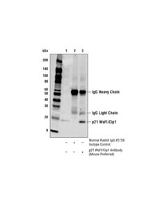 Cell Signaling P21 Waf1/Cip1 Antibody (Mouse Preferred)