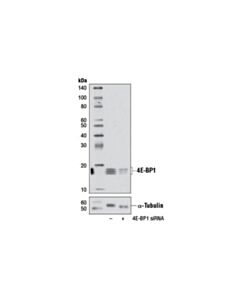 Cell Signaling Signalsilence 4e-Bp1 Sirna I