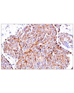 Cell Signaling Stathmin-4 (E9f1y) Rabbit mAb