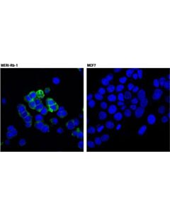 Cell Signaling Cd133 (D2v8q) Xp Rabbit mAb