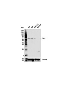 Cell Signaling Chk2 (E7l7j) Rabbit mAb